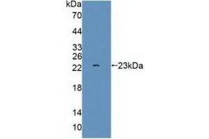 Detection of Recombinant GRIA3, Human using Polyclonal Antibody to Glutamate Receptor, Ionotropic, AMPA 3 (GRIA3) (Glutamate Receptor 3 抗体  (AA 649-823))