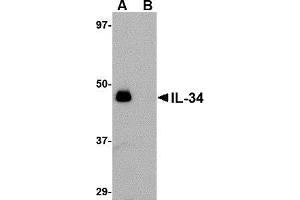 Western blot analysis of IL-34 in human brain tissue lysate with AP30428PU-N IL-34 antibody at 0. (IL-34 抗体  (N-Term))
