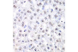 Immunohistochemistry of paraffin-embedded rat liver using Nono Antibody (ABIN5973035) at dilution of 1/100 (40x lens). (NONO 抗体)