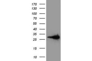 Western Blotting (WB) image for anti-Latexin (LXN) antibody (ABIN1499099) (Latexin 抗体)