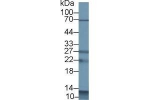 S100A12 anticorps  (AA 2-92)