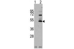 Image no. 1 for anti-Microtubule-Associated Protein tau (MAPT) antibody (ABIN356907) (MAPT 抗体)