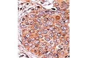 Image no. 2 for anti-SMAD, Mothers Against DPP Homolog 3 (SMAD3) (pSer208) antibody (ABIN358225) (SMAD3 抗体  (pSer208))