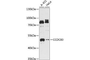 Western blot analysis of extracts of various cell lines, using CCDC83 antibody (ABIN7266444) at 1:3000 dilution. (CCDC83 抗体  (AA 1-300))