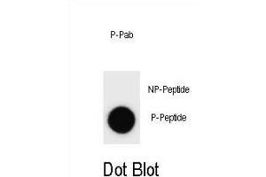Dot blot analysis of Phospho-IKKB- Antibody Phospho-specific Pab (ABIN1539710 and ABIN2839875) on nitrocellulose membrane. (IKBKB 抗体  (pSer689))