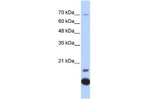 WB Suggested Anti-TXN2 Antibody Titration: 0. (TXN2 抗体  (Middle Region))