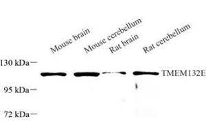 Western blot analysis of TMEM132E (ABIN7075991) at dilution of 1: 250 (TMEM132E 抗体)