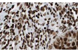 Image no. 3 for anti-Histone Deacetylase 1 (HDAC1) (AA 466-482) antibody (ABIN401309) (HDAC1 抗体  (AA 466-482))
