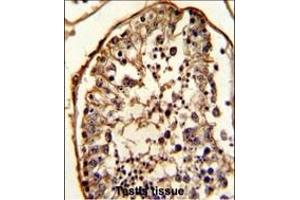 Immunohistochemistry (Paraffin-embedded Sections) (IHC (p)) image for anti-Tubulin, beta (TUBB) antibody (ABIN387758)