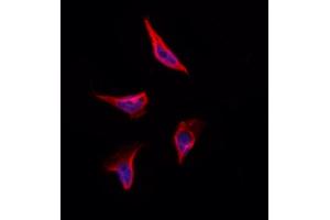 ABIN6264577 and ABIN6273305 staining Hela by IF/ICC.