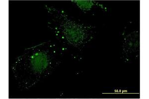 Immunofluorescence of monoclonal antibody to NIT1 on HeLa cell.