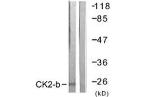 Western blot analysis of extracts from HuvEc cells, using CKII-beta (Ab-209) Antibody. (CSNK2B 抗体  (AA 166-215))