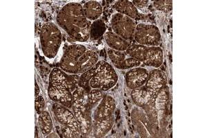 Immunohistochemical staining of human stomach with WDR75 polyclonal antibody  shows strong nuclear, nucleolar and cytoplasmic positivity in glandular cells at 1:50-1:200 dilution.