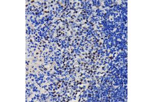 Immunohistochemistry of paraffin-embedded rat spleen using K/TRIM28 antibody (ABIN7270986) at dilution of 1:100 (40x lens). (KAP1 抗体)