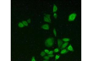 Detection of CYP1A2 in Hela cells using Polyclonal Antibody to Cytochrome P450 1A2 (CYP1A2) (CYP1A2 抗体  (AA 192-444))