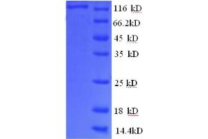SDS-PAGE (SDS) image for phosphorylase, Glycogen, Brain (GPBB) (AA 6-843), (partial) protein (GST tag) (ABIN5712718) (PYGB Protein (AA 6-843, partial) (GST tag))