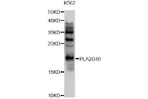 Western blot analysis of extracts of K562 cells, using PLA2G10 antibody (ABIN4904779) at 1:1000 dilution. (PLA2G10 抗体)