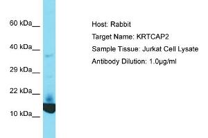 Host: Rabbit Target Name: KRTCAP2 Sample Tissue: Human Jurkat Whole Cell Antibody Dilution: 1ug/ml (KRTCAP2 抗体  (C-Term))