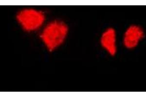 Immunofluorescent analysis of HSP40 staining in HeLa cells. (DNAJB1 抗体  (C-Term))