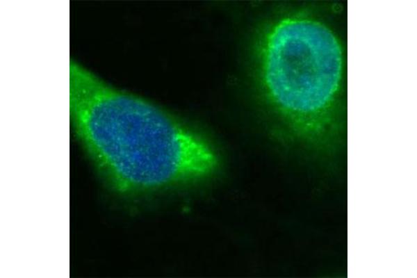 CD36 抗体  (Extracellular Domain)