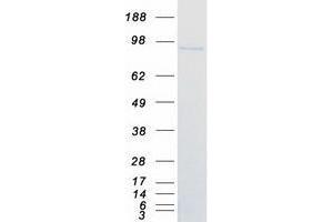 Western Blotting (WB) image for Zinc Finger and BTB Domain Containing 17 (ZBTB17) protein (Myc-DYKDDDDK Tag) (ABIN2735772)