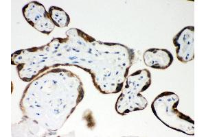 Immunohistochemistry (Paraffin-embedded Sections) (IHC (p)) image for anti-Pregnancy-Associated Plasma Protein A, Pappalysin 1 (PAPPA) (AA 95-388) antibody (ABIN3043377) (PAPPA 抗体  (AA 95-388))