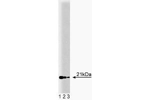 Western blot analysis of RBP on MDCK lysate. (RBP4 抗体  (AA 1-135))