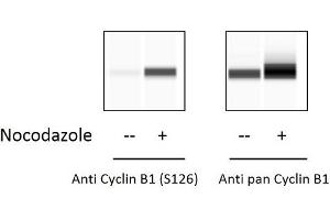 HeLa cells were untreated or treated with Nocodazole for 20 hours. (Cyclin B1 ELISA 试剂盒)