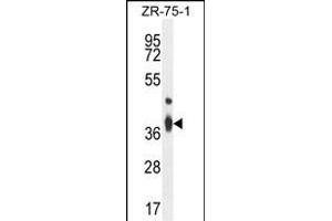 TMBIM4 Antibody (N-term) (ABIN654453 and ABIN2844187) western blot analysis in ZR-75-1 cell line lysates (35 μg/lane).