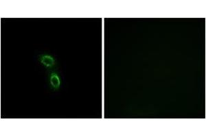 Immunofluorescence analysis of A549 cells, using ARMC6 Antibody. (ARMC6 抗体  (AA 431-480))