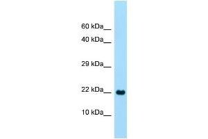 WB Suggested Anti-CLEC2A Antibody Titration: 1. (CLEC2A 抗体  (C-Term))