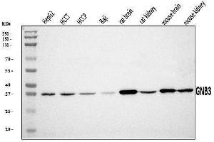 Western blot analysis of GNB3 using anti-GNB3 antibody (ABIN7599726).