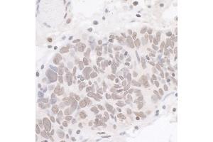 anti-Cyclin-Dependent Kinase 7 (CDK7) (C-Term) antibody