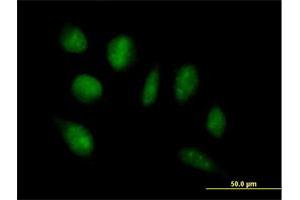 Immunofluorescence of purified MaxPab antibody to ADAMTSL4 on HeLa cell. (ADAMTSL4 抗体  (AA 1-424))