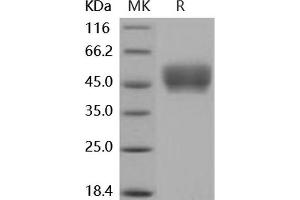 Western Blotting (WB) image for Fc Receptor, IgG, High Affinity I (FCGR1) (Active) protein (His tag) (ABIN7195718)