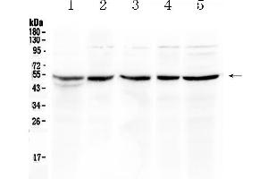 Western blot analysis of EIF3e using anti- EIF3e antibody . (EIF3E 抗体  (AA 160-241))