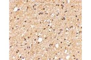 Immunohistochemistry (IHC) image for anti-Leucine-Rich Repeat LGI Family, Member 2 (LGI2) (Middle Region) antibody (ABIN1030982) (LGI2 抗体  (Middle Region))