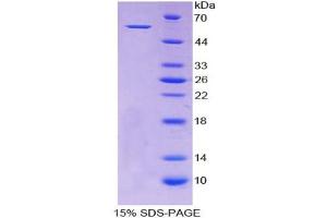 SDS-PAGE analysis of Human ALDH7A1 Protein. (ALDH7A1 蛋白)