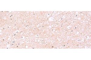 Immunohistochemistry of paraffin-embedded Human brain tissue using RABEPK Polyclonal Antibody at dilution of 1:85(x200) (RABEPK 抗体)
