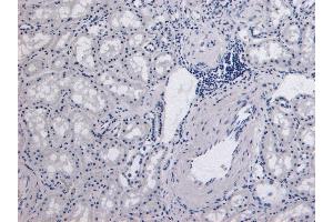 (ABIN185651) Negative Control showing staining of paraffin embedded Human Kidney, with no primary antibody. (Catalase 抗体  (Internal Region))