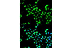 Immunofluorescence analysis of A549 cell using METTL13 antibody. (METTL13 抗体)