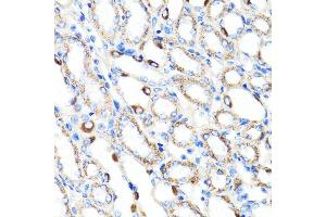 Immunohistochemistry of paraffin-embedded mouse kidney using RNF149 antibody (ABIN7270062) at dilution of 1:100 (40x lens). (RNF149 抗体  (AA 221-400))