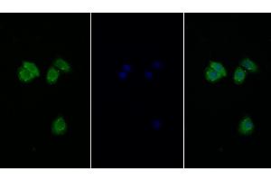 Detection of EIF2aK3 in Human Hela cell using Polyclonal Antibody to Eukaryotic Translation Initiation Factor 2 Alpha Kinase 3 (EIF2aK3) (PERK 抗体  (AA 973-1114))