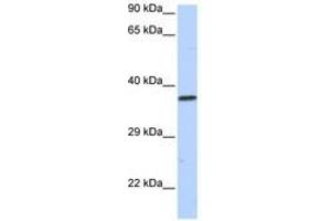 Image no. 1 for anti-Sex Comb On Midleg-Like 1 (SCML1) (AA 36-85) antibody (ABIN6740440) (SCML1 抗体  (AA 36-85))