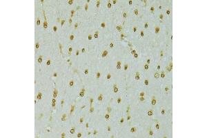 Immunohistochemistry of paraffin-embedded rat brain using RCC1 antibody. (RCC1 抗体  (AA 1-240))