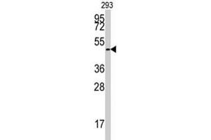 Western blot analysis of E2F1 polyclonal antibody  in 293 cell line lysates (35 ug/lane). (E2F1 抗体  (Ser332))