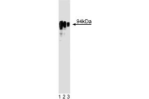 Western blot analysis of glucocorticoid receptor on HeLa cell lysate (right). (Glucocorticoid Receptor 抗体  (AA 176-289))