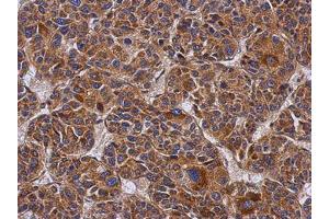 Image no. 1 for anti-Coiled-Coil Domain Containing 50 (CCDC50) (AA 1-187) antibody (ABIN1497124) (CCDC50 抗体  (AA 1-187))