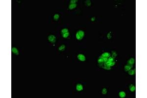 Immunofluorescent analysis of MCF-7 cells using ABIN7143011 at dilution of 1:100 and Alexa Fluor 488-congugated AffiniPure Goat Anti-Rabbit IgG(H+L) (PHAP1 抗体  (AA 1-170))