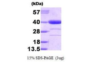 Figure annotation denotes ug of protein loaded and % gel used. (Alcohol Dehydrogenase (ADH) (AA 1-325) 蛋白)